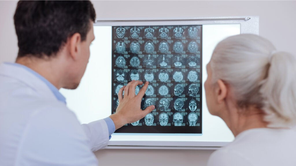 Comprendiendo y tratando el adenoma hipofisario