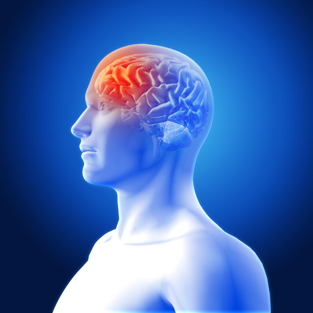 metástasis cerebrales