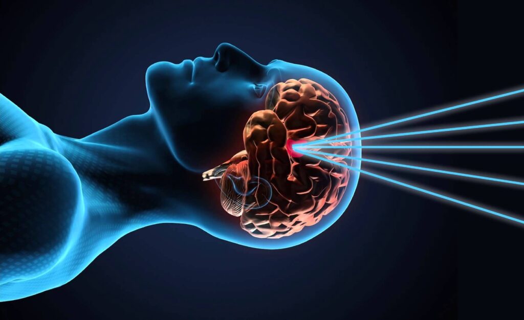 Gamma Knife Surgery