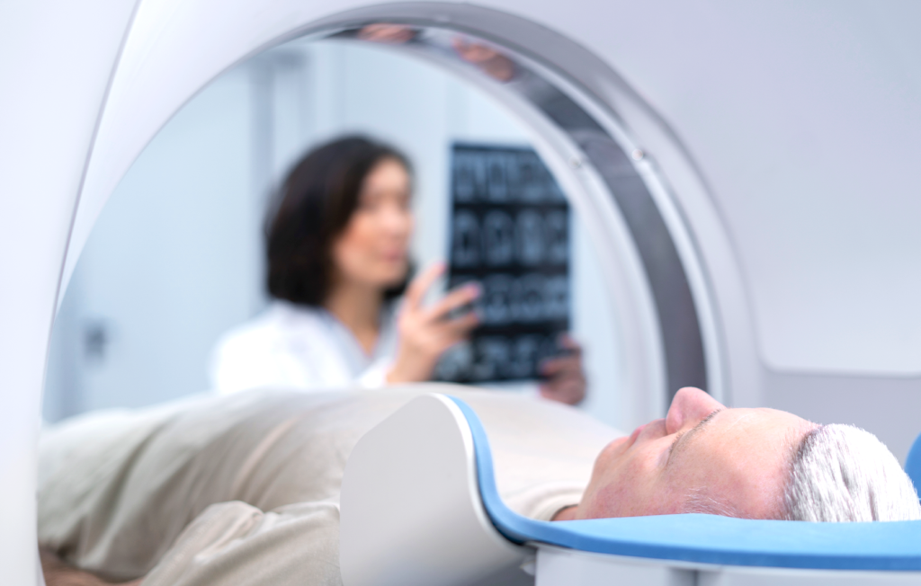 Los meningiomas: ¿qué son y cómo se previenen?