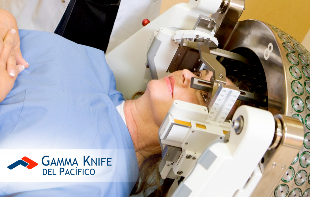 Gamma Knife: Avance revolucionario en el tratamiento de la metástasis cerebral
