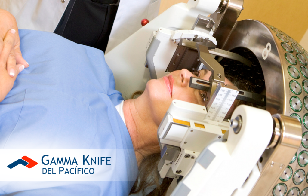 ¡3 Mitos del Gamma Knife que debes desterrar hoy mismo!