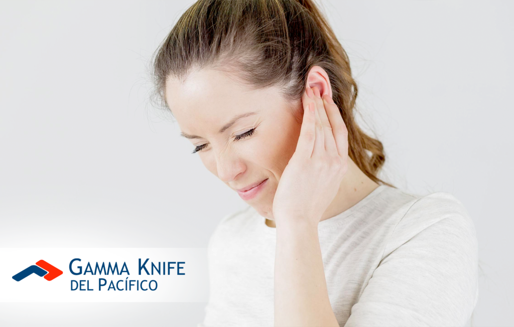 Tratamiento de Neurinomas del Acústico con Gamma Knife