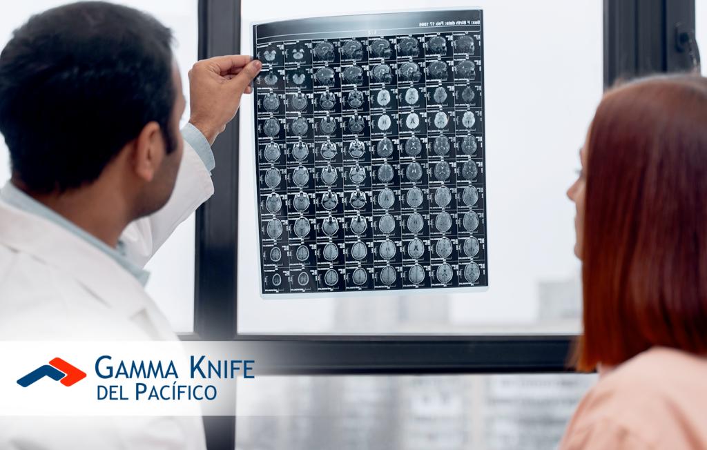 Diagnóstico de los adenomas de hipófisis: técnicas y herramientas utilizadas