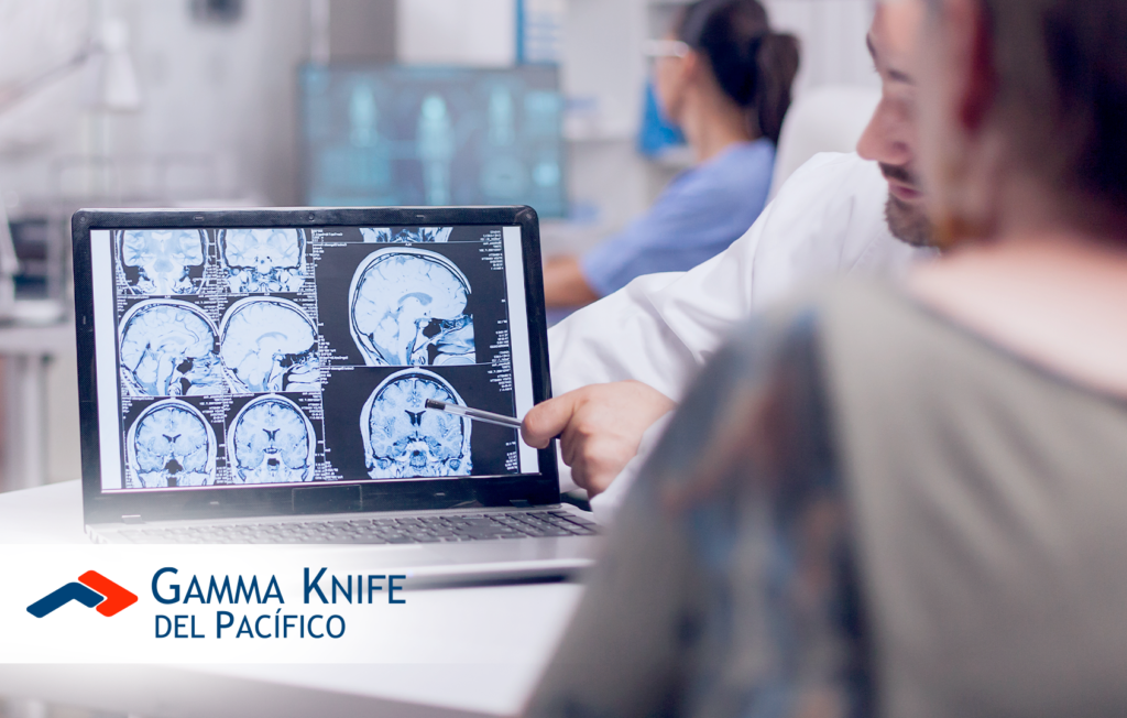 Gamma Knife: Una nueva esperanza en el tratamiento del TOC
