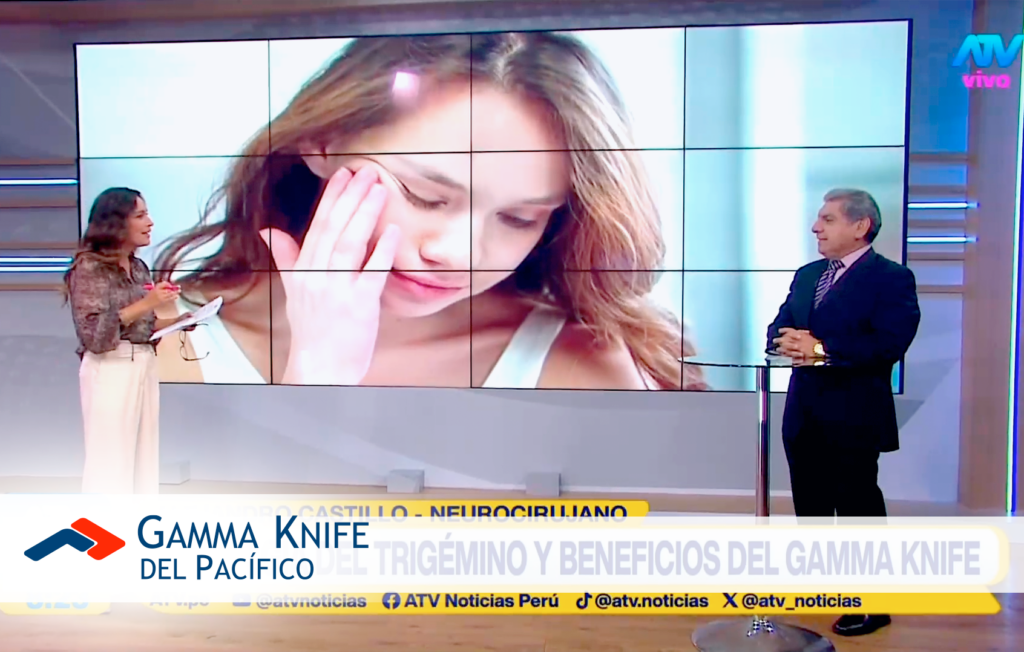 Neuralgia del Trigémino y Beneficios del Gamma Knife