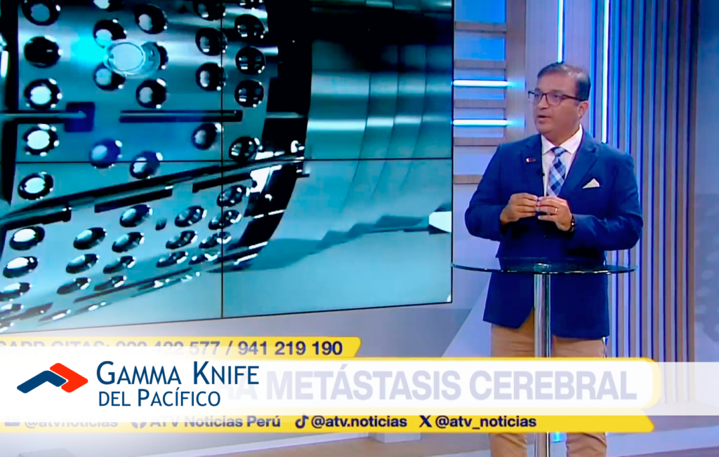 Gamma Knife: esperanza real contra la metástasis cerebral